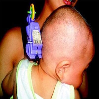 Cách xử lý thông minh khi con bị vật nhọn đâm vào người 5