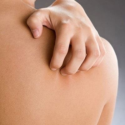 Cách điều trị và phòng tránh ung thư da 3