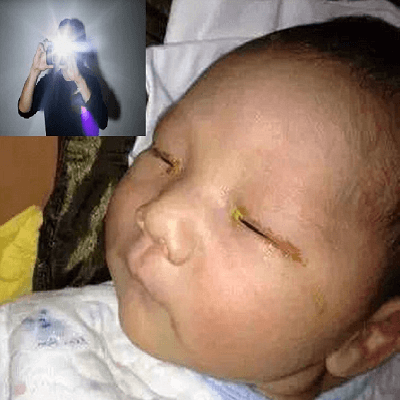 Hãy dừng ngay việc chụp ảnh cho bé có đèn flash! 5