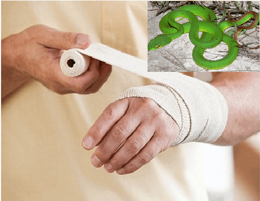 Kỹ năng sơ cứu giúp bảo toàn tính mạng khi bị rắn cắn 5