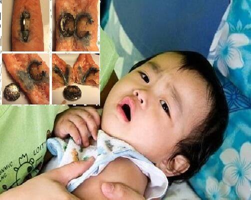 Pin cúc áo, sát thủ thầm lặng rình rập gia đình bạn 5