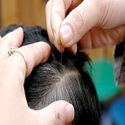 Chữa tóc bạc sớm bằng các nguyên liệu tự nhiên sẵn có 3