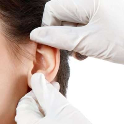 Rò luân nhĩ ở trẻ em 3
