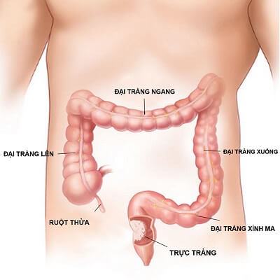 Các yếu tố gia đình có nguy cơ gây ra 20% ung thư đại trực tràng 3