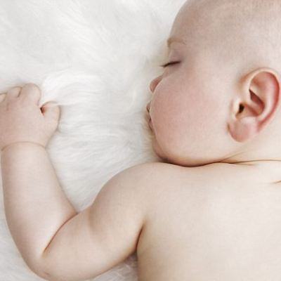 Dính khớp sọ sớm là gì? 3