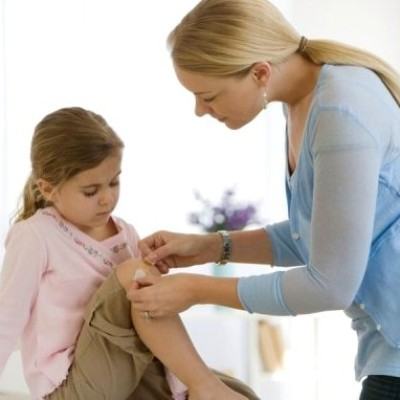 Chăm sóc vết bỏng cho con như thế nào? 3