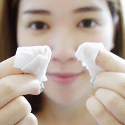 Hướng dẫn nặn mụn đúng cách không để lại sẹo thâm 3