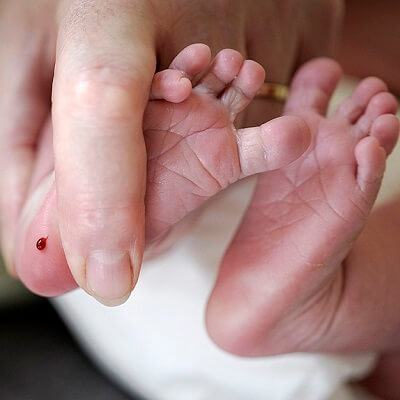 Những điều mẹ nhất thiết phải biết về xét nghiệm sàng lọc sơ sinh 3