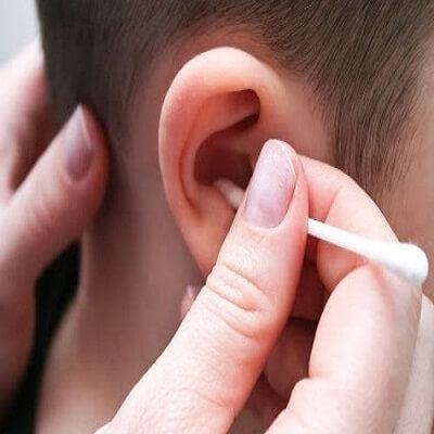 Hơn 12.000 trẻ em nhập viện mỗi năm vì bông ráy tai 5