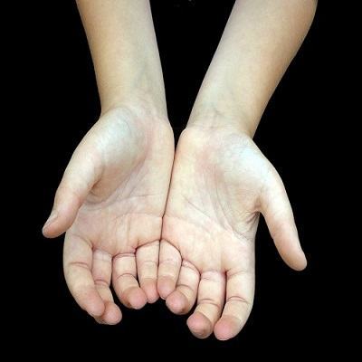 Đoán tình trạng sức khỏe qua bộc lộ của bàn tay 3