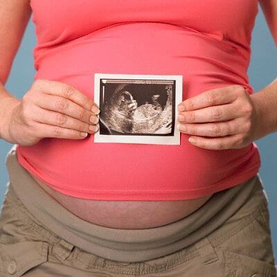 5 điều mẹ bầu cần làm ngay để con không bị khuyết tật 3