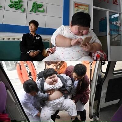 Sốc nặng vì bé gái 75kg, mỗi tháng lại tăng thêm 10kg 9