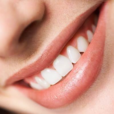 Điểm danh những yếu tố hàng đầu làm hỏng răng 9