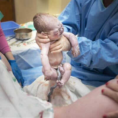 Những hình ảnh tuyệt đẹp về dây rốn của trẻ sơ sinh 3