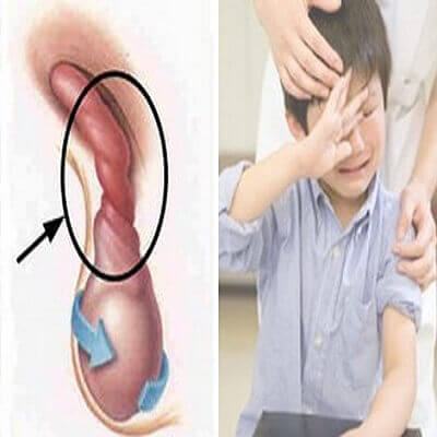 Coi chừng hoại tử tinh hoàn khi con kêu đau vùng kín 5