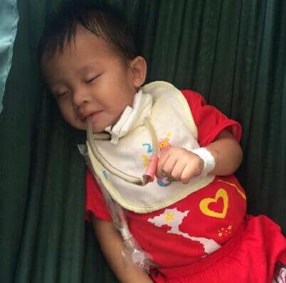 Cháu bé uống nhầm a xít gần 1 năm không ăn được cơm 4