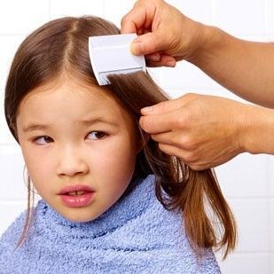 7 mẹo "đuổi" sạch chí trên đầu bé bằng những nguyên liệu có sẵn 4