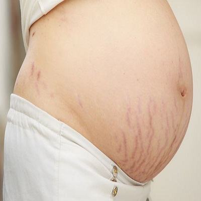 Xua tan chứng ngứa ngáy khó chịu khi mang thai 6