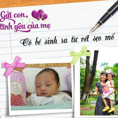 Cô bé sinh ra từ vết sẹo mổ 6
