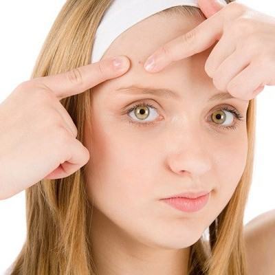 Sạch mụn trứng cá đón Tết với 7 loại thực phẩm sau 7