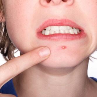 4 công thức làm đẹp đơn giản từ rau diếp cá cho bạn làn da đẹp không tì vết 5
