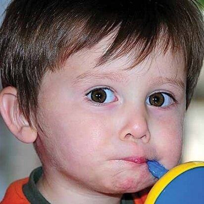 9 triệu chứng giúp mẹ nhận diện nhanh mắt bé đang gặp vấn đề về thị lực 4