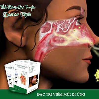 Thảo dược gia truyền Doctor Ninh đặc trị viêm mũi dị ứng 6