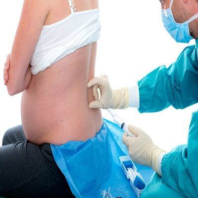 Gây tê ngoài màng cứng, thủ thuật “đẻ không đau” mẹ nào cũng cần biết 4