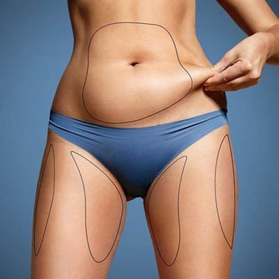 Gọt dáng bằng nước đá với giá rẻ như bèo 6