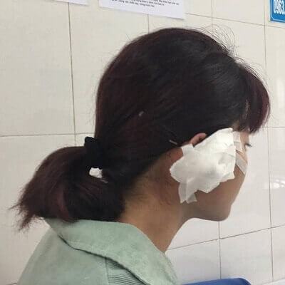 Phụ huynh cắn đứt tai giáo viên vì bức xúc cách dạy con 7