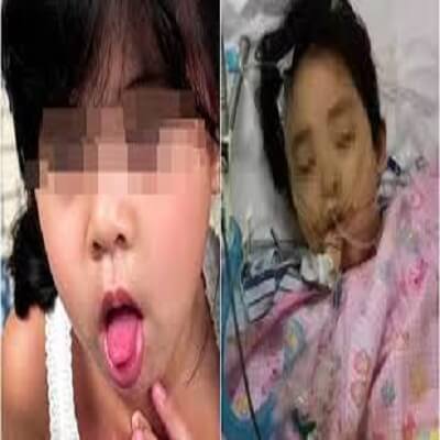 Trẻ bị hóc dị vật: Cách xử lý sai lầm của người lớn 3