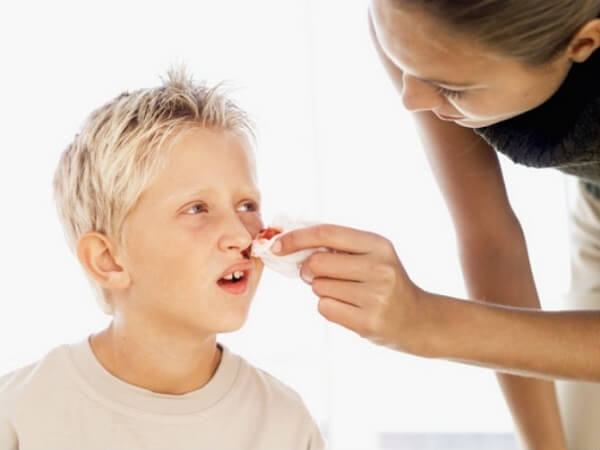 Sơ cứu đúng cách khi con bị chảy máu 3
