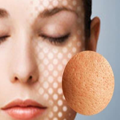 Từ bỏ 5 thói quen này, nếu không lỗ chân lông sẽ ngày một to ra 8