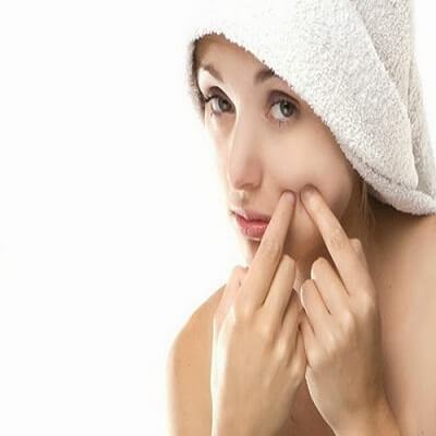5 bước nặn mụn đúng cách không để lại sẹo và vết thâm 6