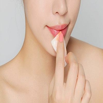 Vô vàn cách trị thâm môi hiệu quả tại nhà 3