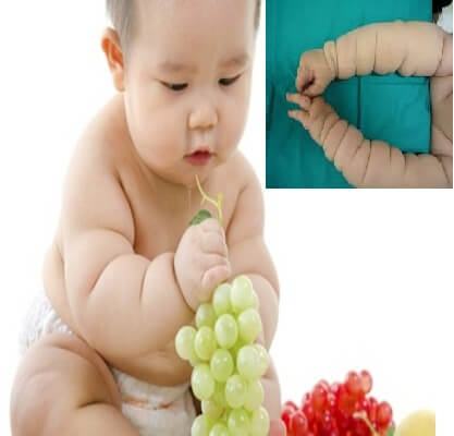 Chân tay con nhiều ngấn, bố mẹ chớ vội mừng 4