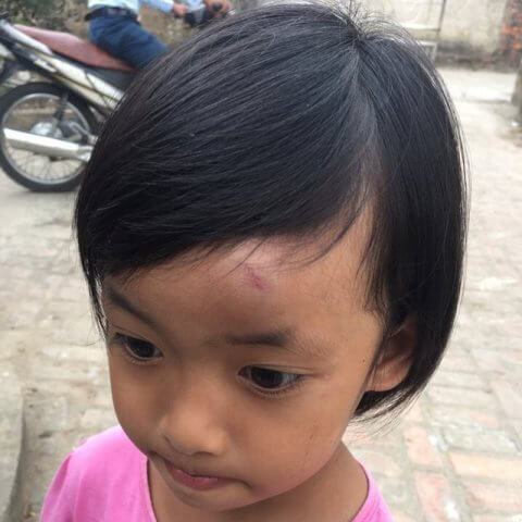 Bé 4 tuổi bị cô giáo ném dép vào trán vì... nói chuyện trong lớp 4