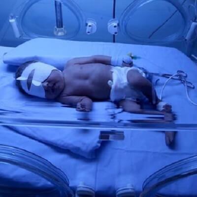 Mỹ: Bé gái nguy kịch vì nhiễm virut herpes của người tới thăm 4