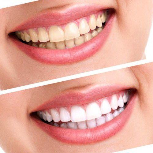 Sở hữu hàm răng trắng sáng trong "nháy mắt" chỉ với húng quế và vỏ cam 4
