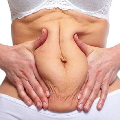 4 cách làm săn chắc da bụng sau sinh cho mẹ yên tâm 3