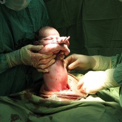 Bộ ảnh: Xúc động đến nghẹt thở về một ca sinh mổ chân thực đến từng cen-ti-mét 7