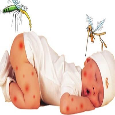 Mẹ phải làm gì khi bé bị côn trùng đốt? 4