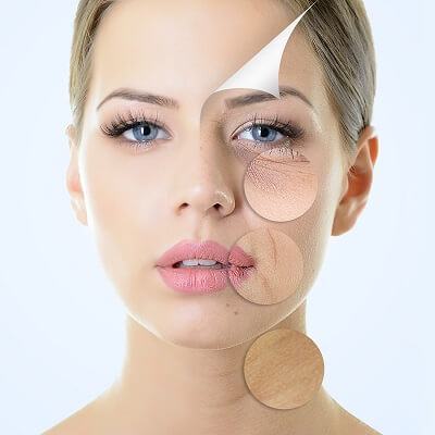 Những dấu hiệu giúp bạn nhận biết cơ thể đang thiếu hụt collagen 3