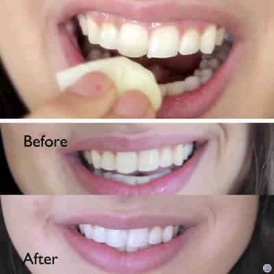 Video: Tẩy răng trắng sáng chỉ trong 2 phút bằng chanh tươi 4