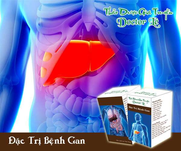 Thảo dược đặc trị bệnh gan, xơ gan, men gan cao, gan nhiễm mỡ 34 Thảo dược đặc trị bệnh gan, xơ gan, men gan cao, gan nhiễm mỡ