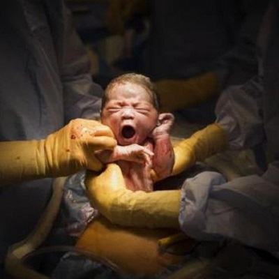 Tuyệt đẹp khoảnh khắc bé yêu rời khỏi bụng mẹ 3