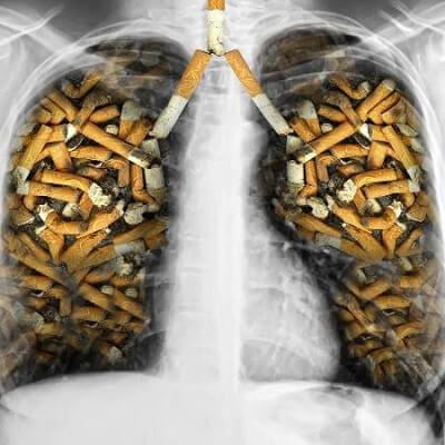 Hoang mang trước những hóa chất "giết người" được tìm thấy trong thuốc lá 5