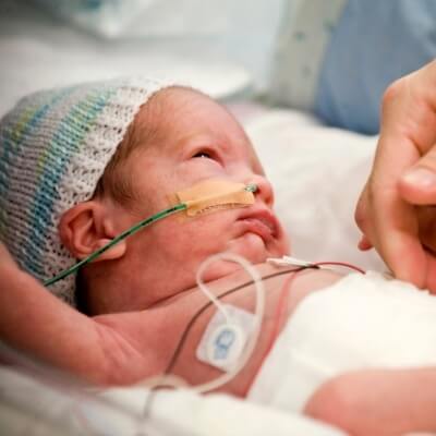 Trẻ sinh non dễ mắc chứng loãng xương khi trưởng thành 4
