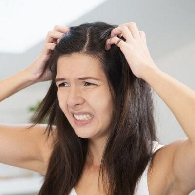 Trị gàu dứt điểm với những nguyên liệu dễ kiếm 3