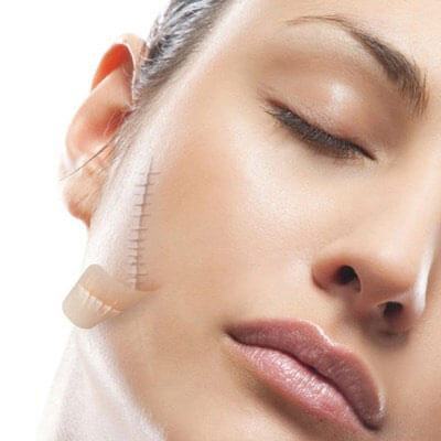 Loại bỏ sẹo ở cổ bằng những nguyên liệu có sẵn trong nhà 7